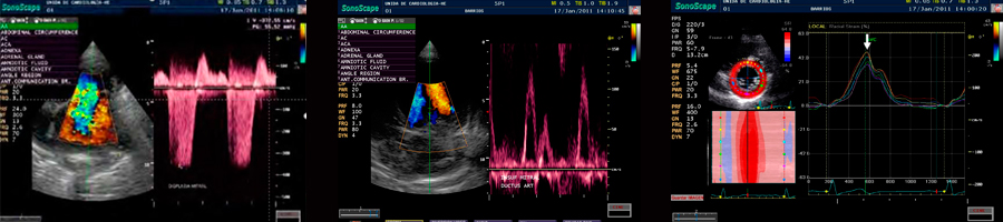 Cardiología Veterinaria